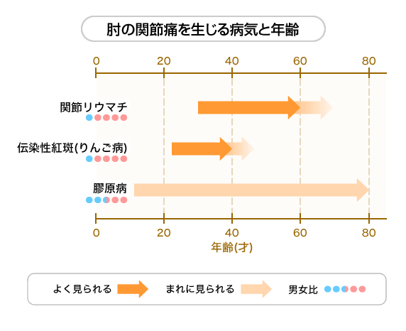 肘の関節痛を生じる内科の病気と年齢、男女比