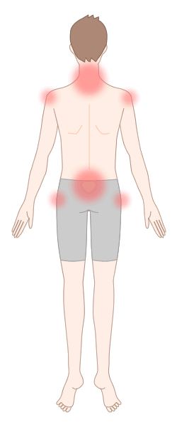 強直性脊椎炎で生じる痛みの部位