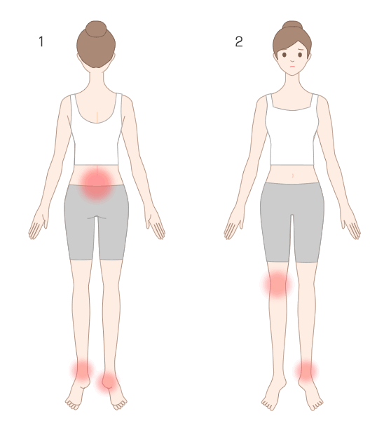 1）反応性関節炎、2）炎症性腸疾患に伴う関節炎で生じる痛みの部位