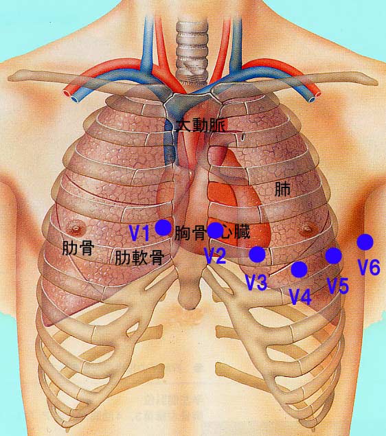右からV1から順にV6まで心臓を水平方向に場所を変えながら心電図を記録します