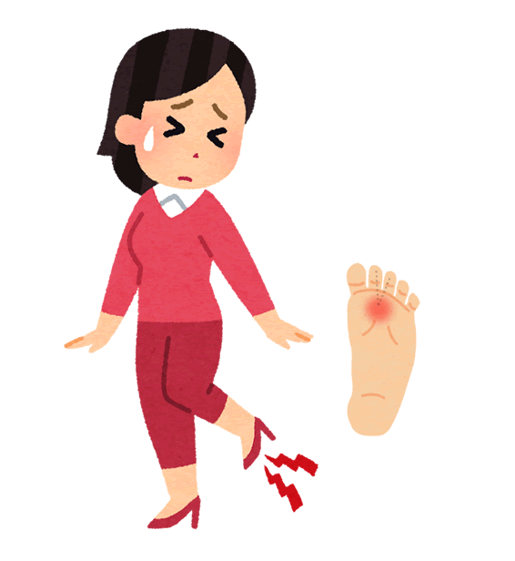 歩くと足の裏に激痛：モートン病